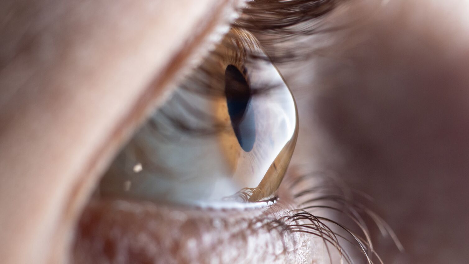 Detailaufnahme eines Auges zur Augenkrankheit Keratakonus