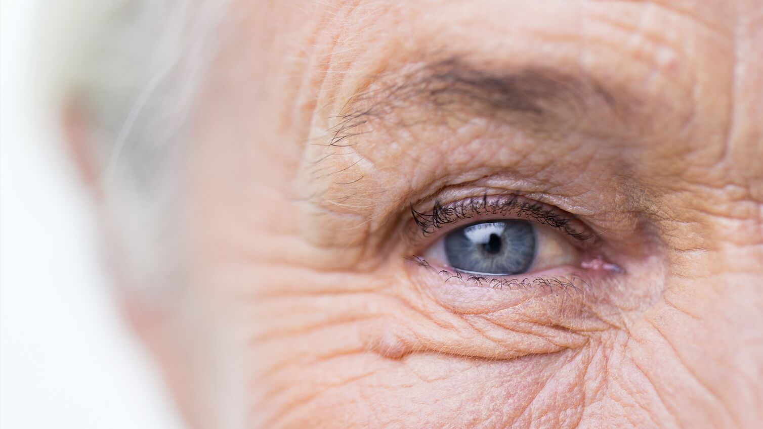 Auge einer älteren Frau als Symbolbild für altersbedingte Makuladegeneration